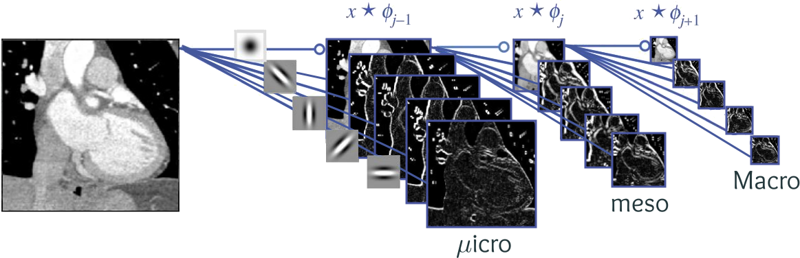 Wavelet Transform