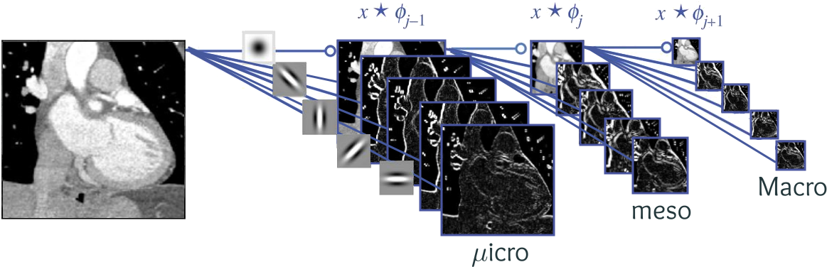 Wavelet transform Wavelet transform