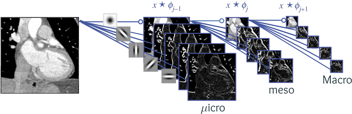 Wavelet transform